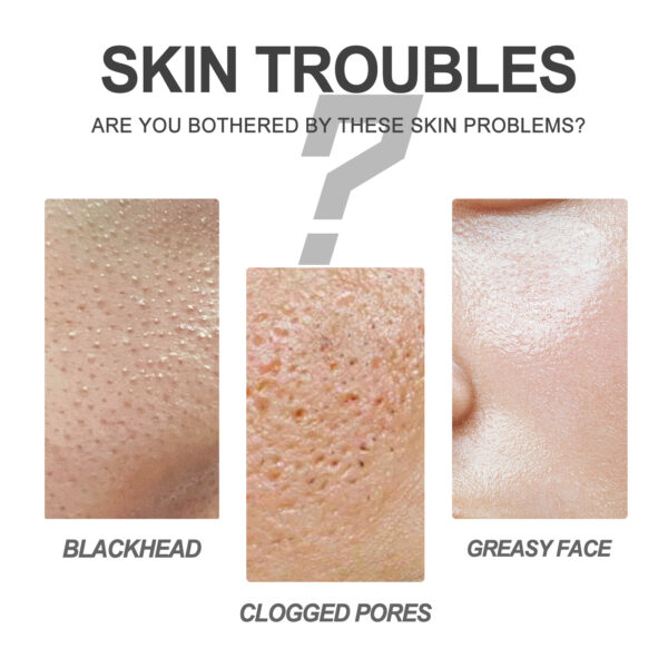 EELHOE Blackhead Cleansing Cream Skin Oil Blackheads Acne Exfoliating Cleansing Repair Pore Tearing Nose Patch - Image 5
